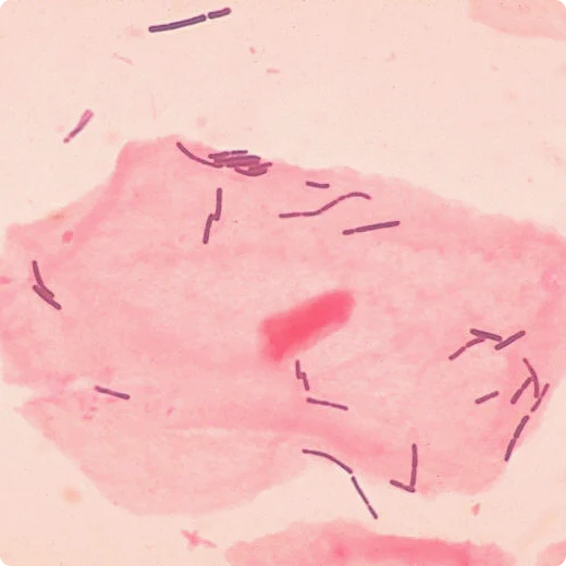 Lactobacillus bulgaricus