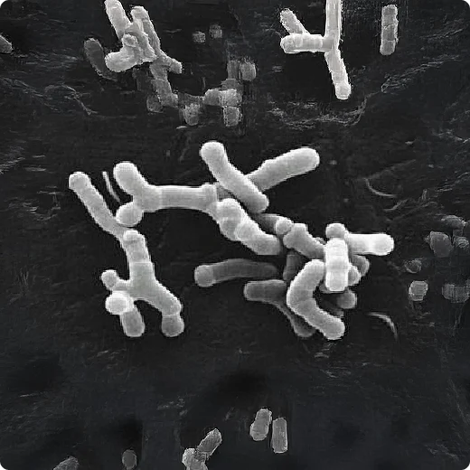Bifidobacterium longum